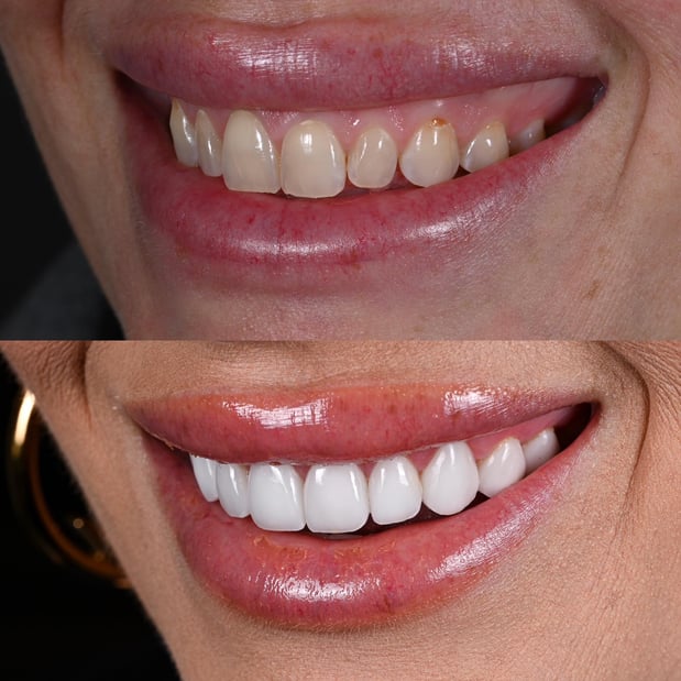 Images Nashville Wisdom Teeth and Implant Solutions