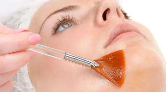 SkinMedica Peels