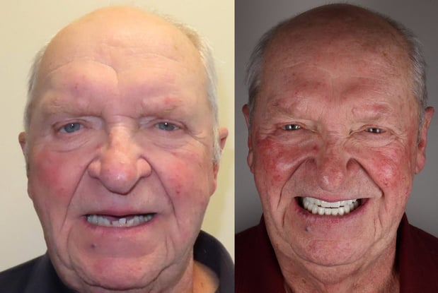 Images LaFayette Dental Associates