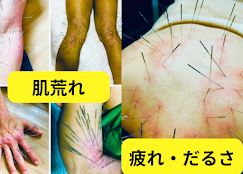 Images 鍼処KAKUREGA