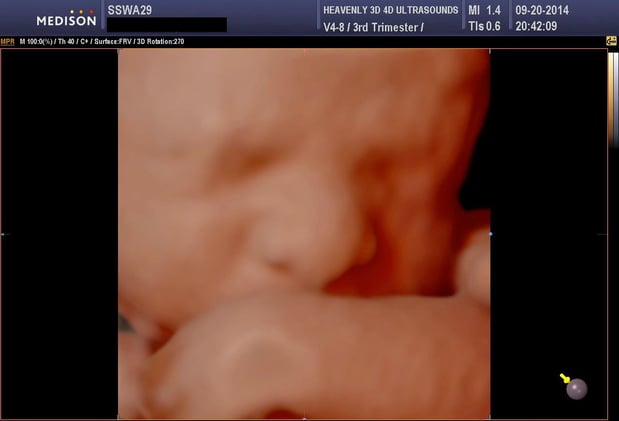 Images Heavenly 3D 4D Ultrasounds-Upland