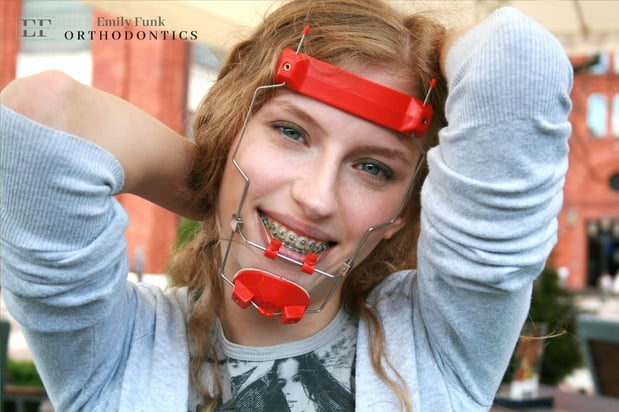 Images Emily Funk Orthodontics