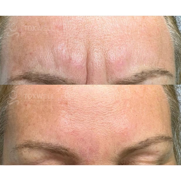Images Toxwell Med Spa and Wellness