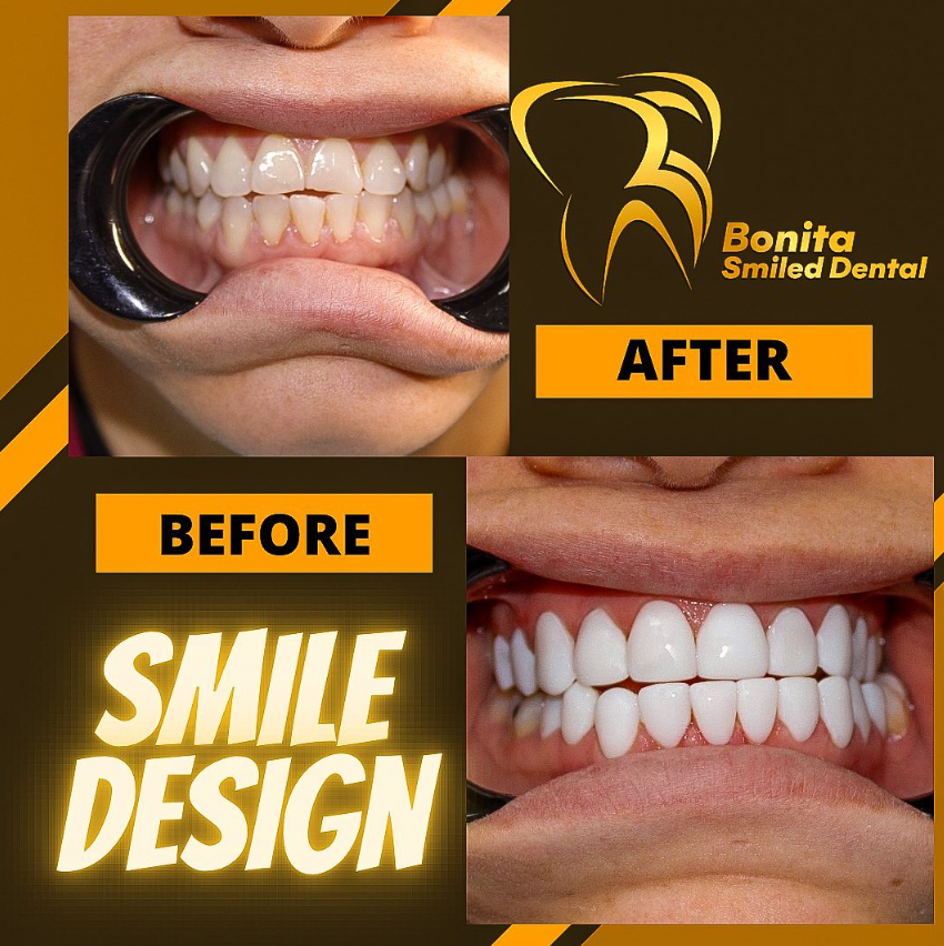 Bonita Smiled Dental - smile design