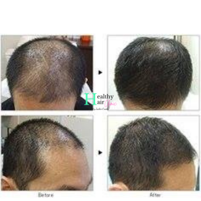 Images Healthy Hair Clinic