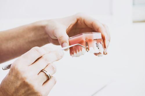 Image 7 | Dentist Huntington Beach CA - Dr. Sam Ayoub, DDS