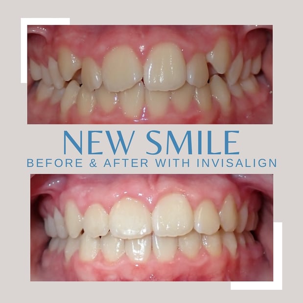 Images Stoutland and Hayes Orthodontics