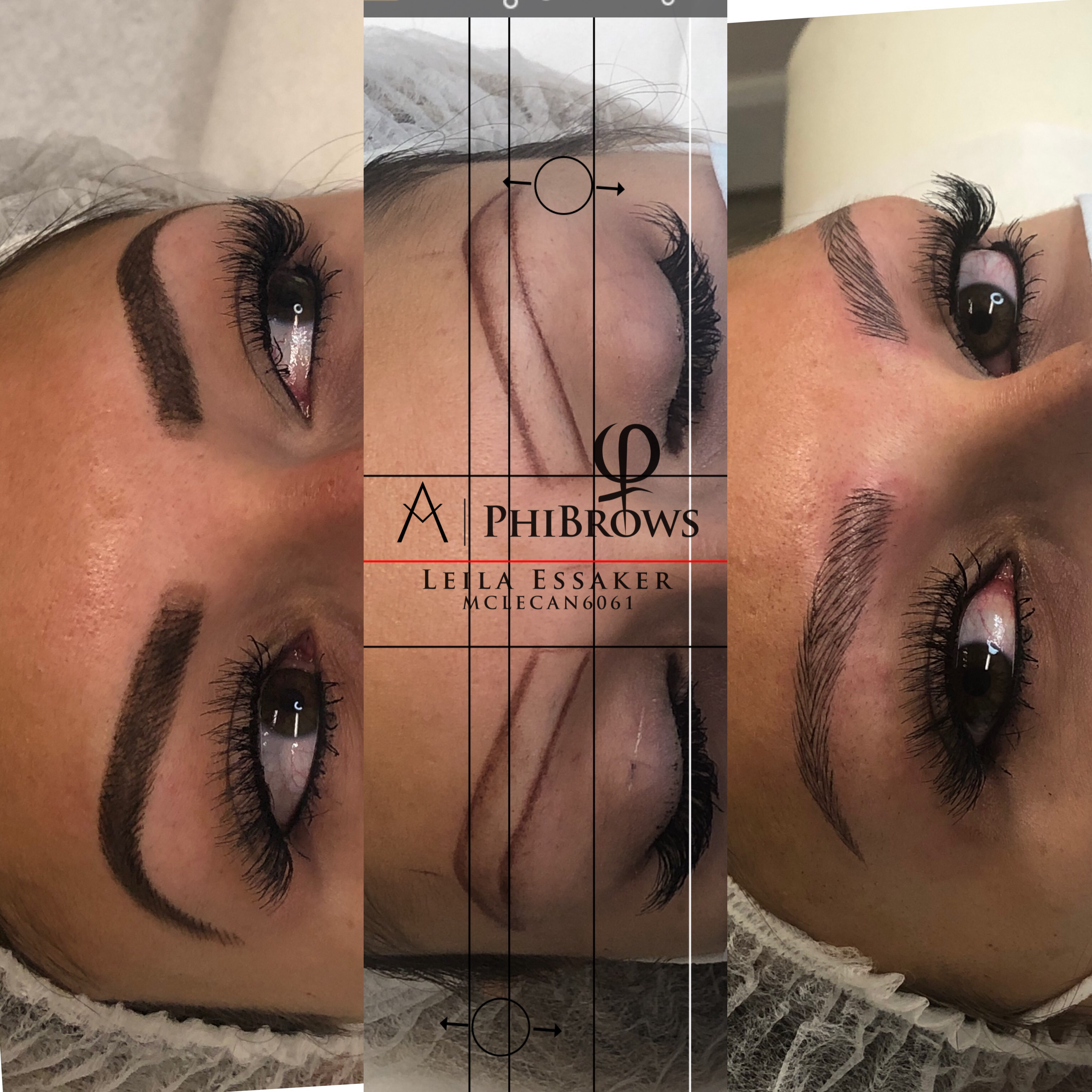 Images Clinique d'Esthétique Leila - Hydrafacial, Microblading, Épilation Laser Sainte-Foy