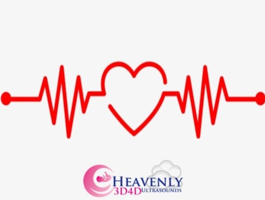 Images Heavenly 3D 4D Ultrasounds