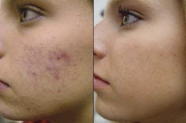 Images Meo D.Rssa Anna Laura Dermatologa