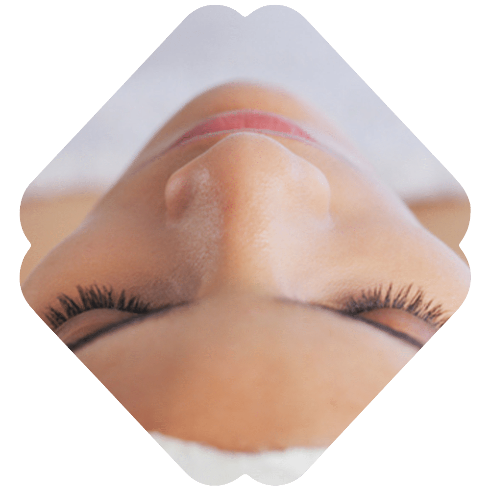 Facial Acne Treatments Redondo Beach