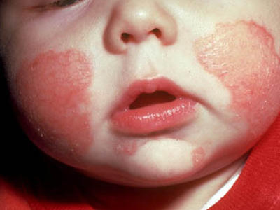 Images The Woodlands Allergy Asthma & Immunology Center