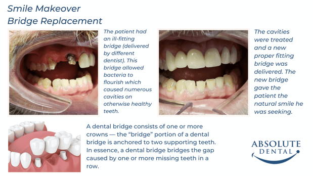 Images Absolute Dental
