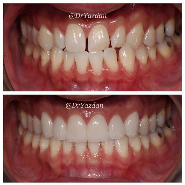 Images Dr. Desiree Yazdan - Center For Restorative & Cosmetic Dentistry