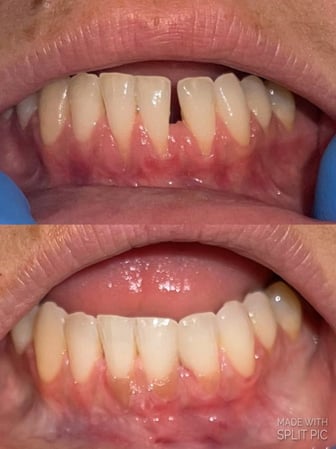 Images Alford Family Dentistry