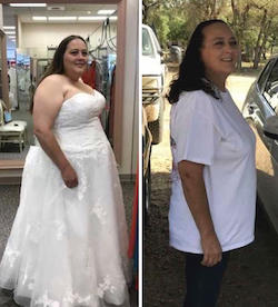 Meet Betty Panhandle Weight Loss Center Amarillo (806)677-7952
