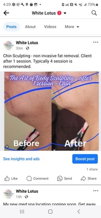 Images White Lotus Health and IV Wellness