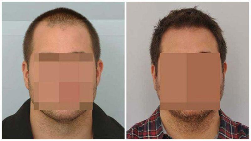 Images ForHair NYC Restoration Clinic - Dr. John Cole