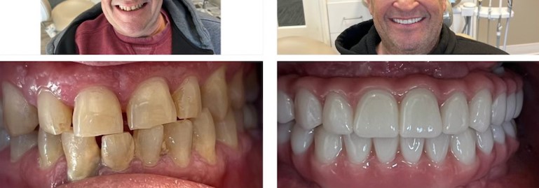 Images Lincoln Family Dentistry