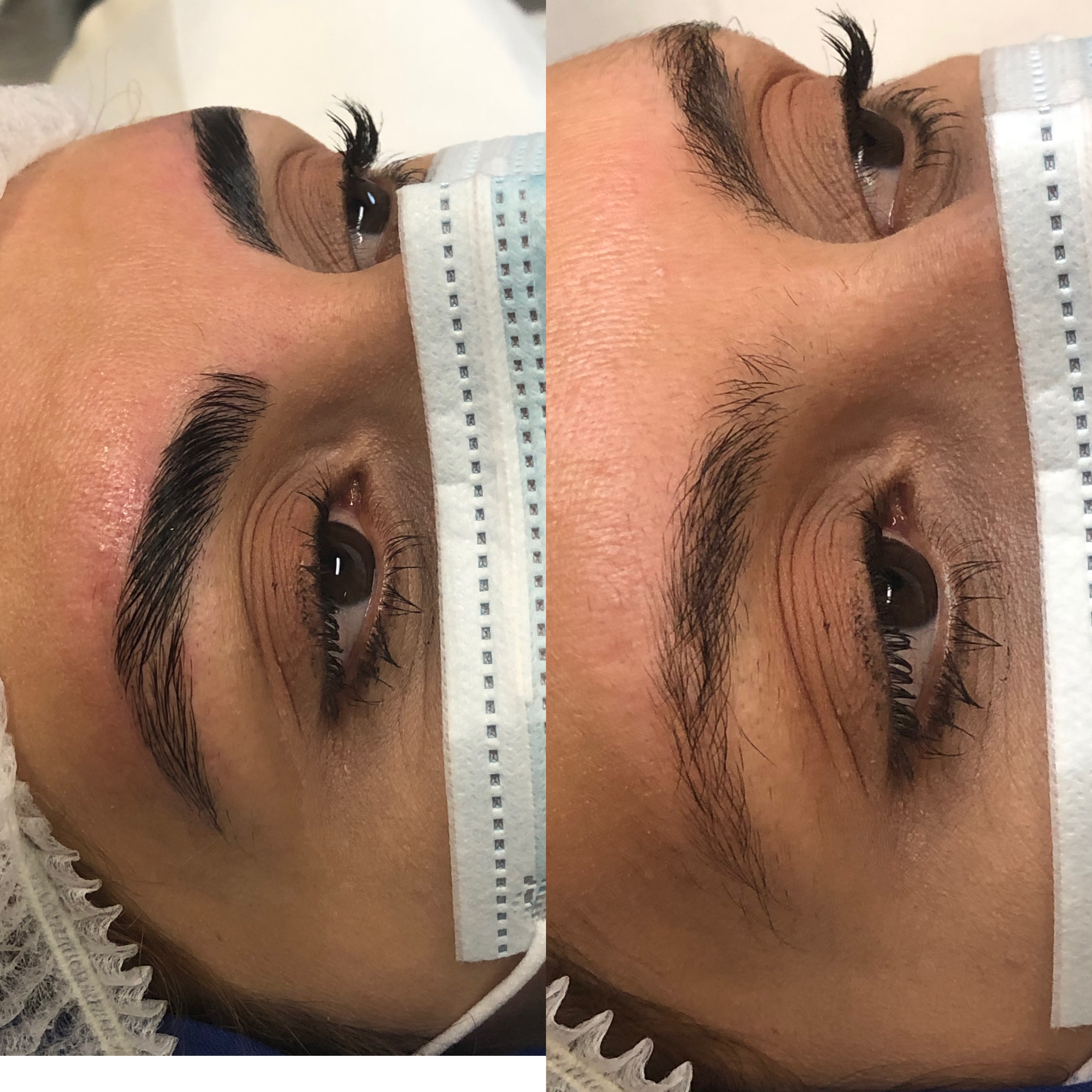 Images Clinique d'Esthétique Leila - Hydrafacial, Microblading, Épilation Laser Sainte-Foy