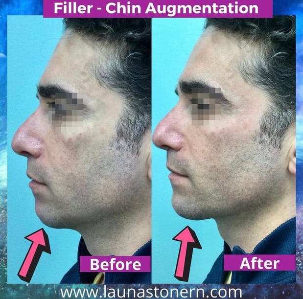 Images Launa Stone, R.N.