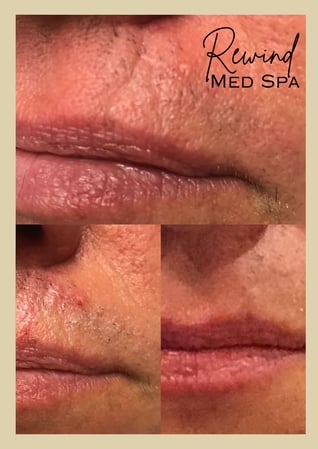 Images Rewind Med Spa