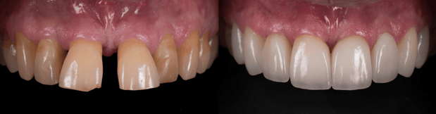 Images Jeppson Dental