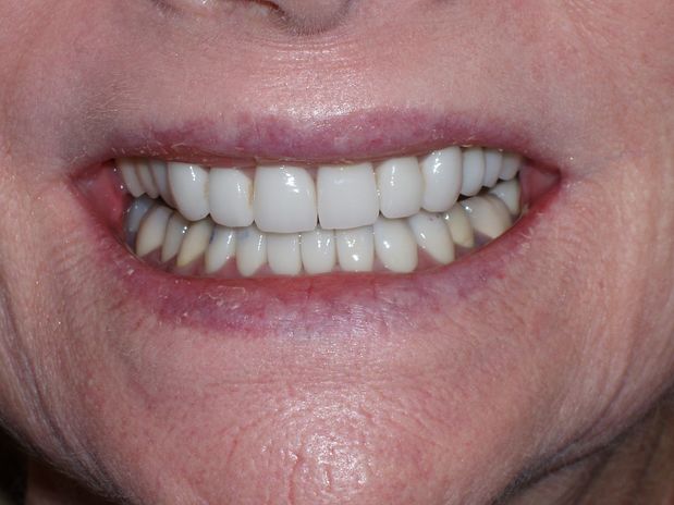 Images Aaron A. Leishman DMD, PA