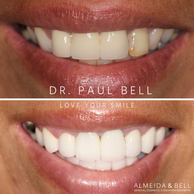 Images Almeida & Bell Dental Lone Tree - General, Cosmetic, and Implant Dentistry