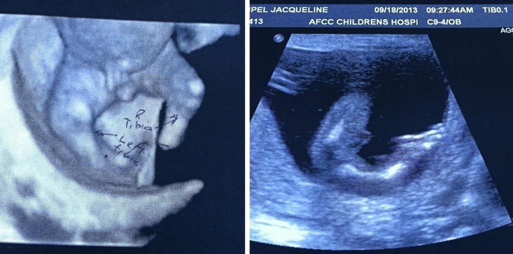 Fotos - PHOENIX ULTRASOUND - 18