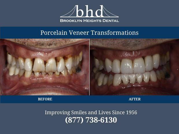 Images Brooklyn Heights Dental