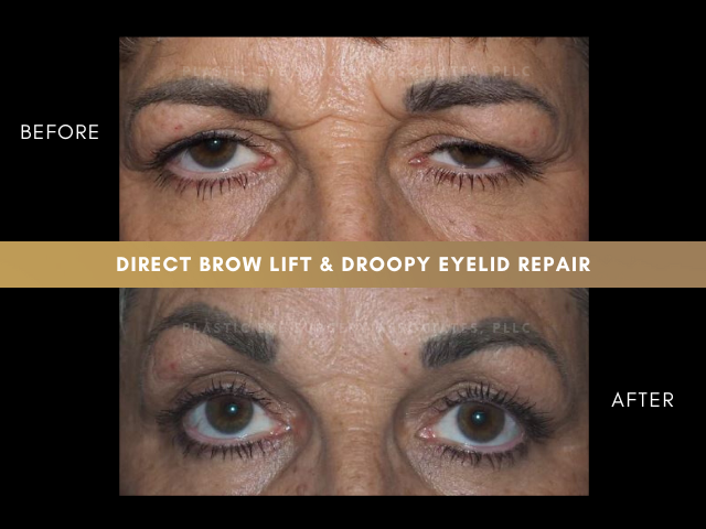 Images Plastic Eye Surgery Associates, PLLC