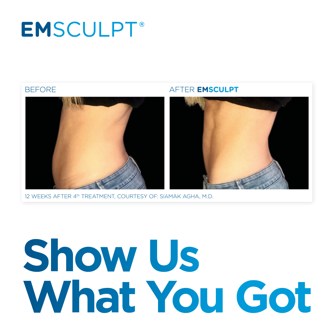 Sculpted and toned abs in 2 weeks without breaking a sweat? YES PLEASE!! Schedule your FREE EMSCULPT, body sculpting session and MD consult today @ https://columbusEMSCULPT.com
