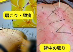 Images 鍼処KAKUREGA