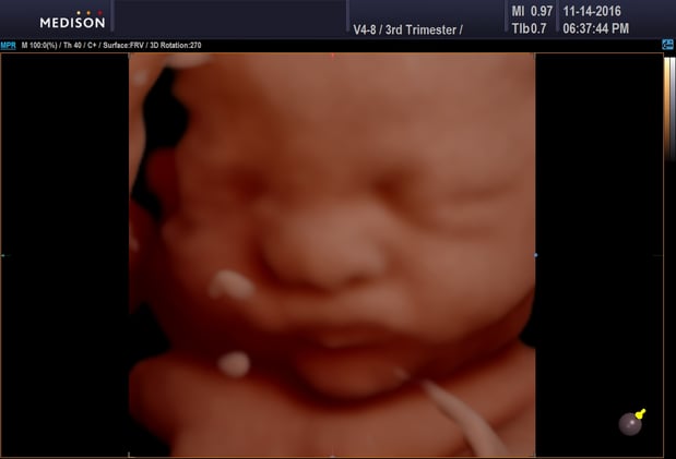 Images Heavenly 3D 4D Ultrasounds