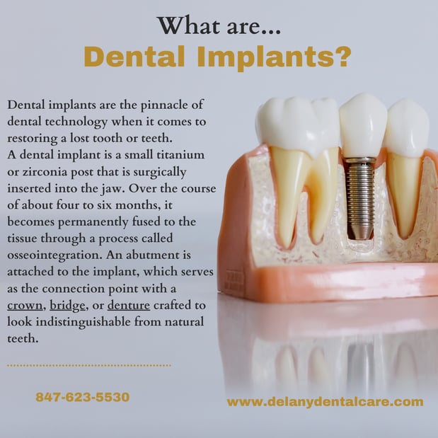 Images Delany Dental Care