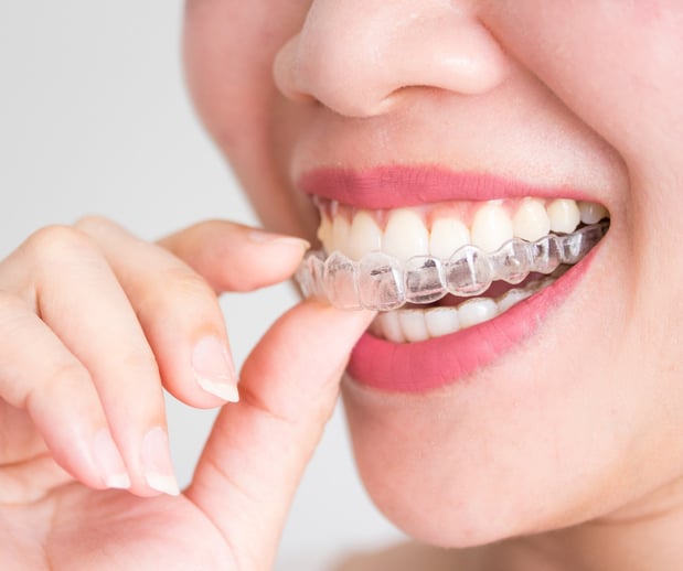Images Silver State Dental