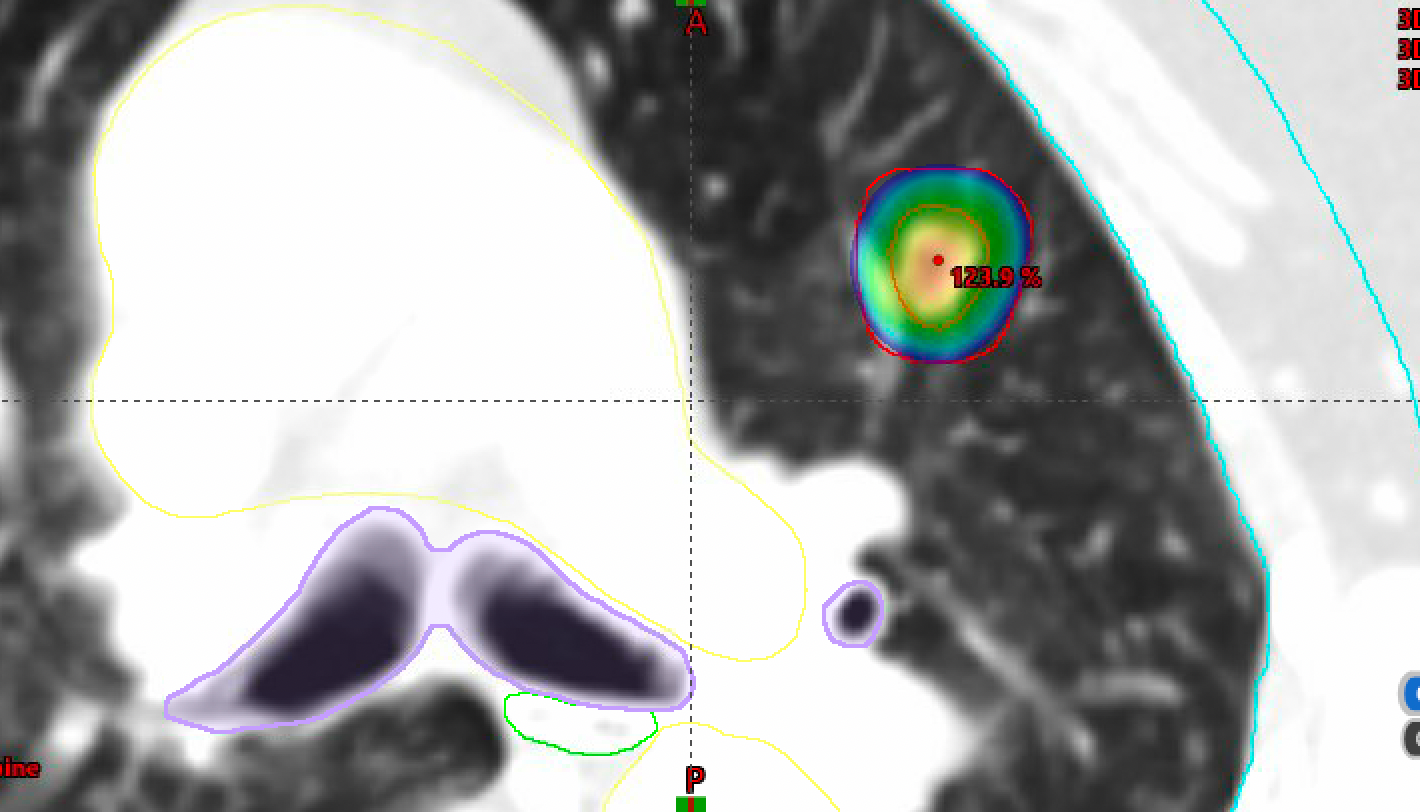 Images Dr James Wilson - Oncologist London