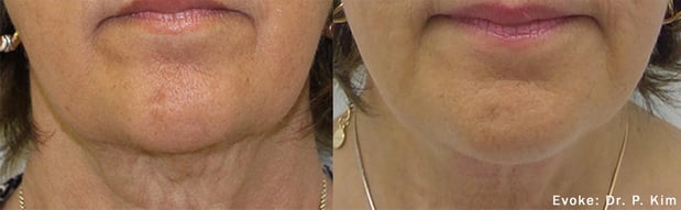 Images Engle Dentistry