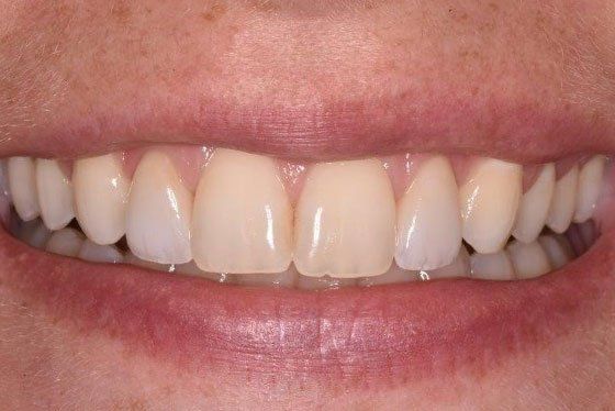 Images Bedminster Family & Cosmetic Dentistry
