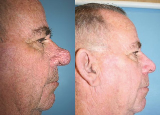 Before & After from Thomas F. Mitts, MD, Inc. | Visalia, CA