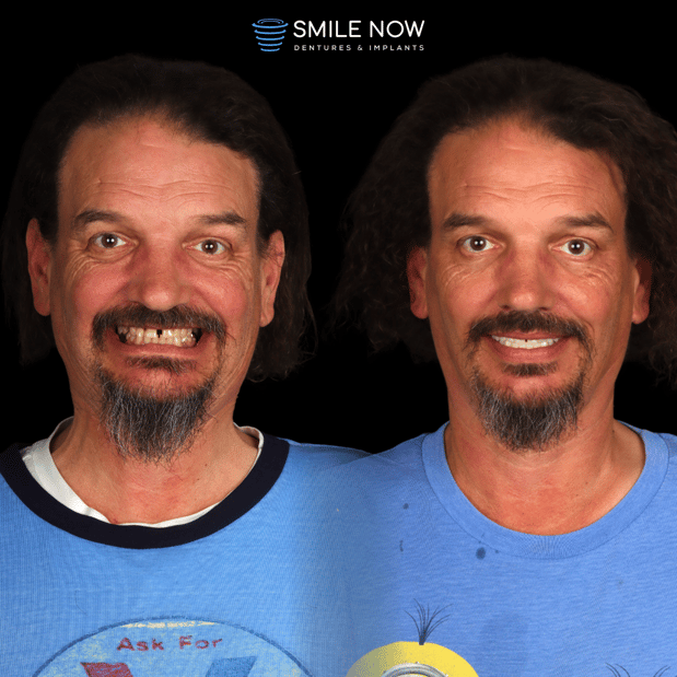 Images Smile Now Milwaukee Dentures and Implants