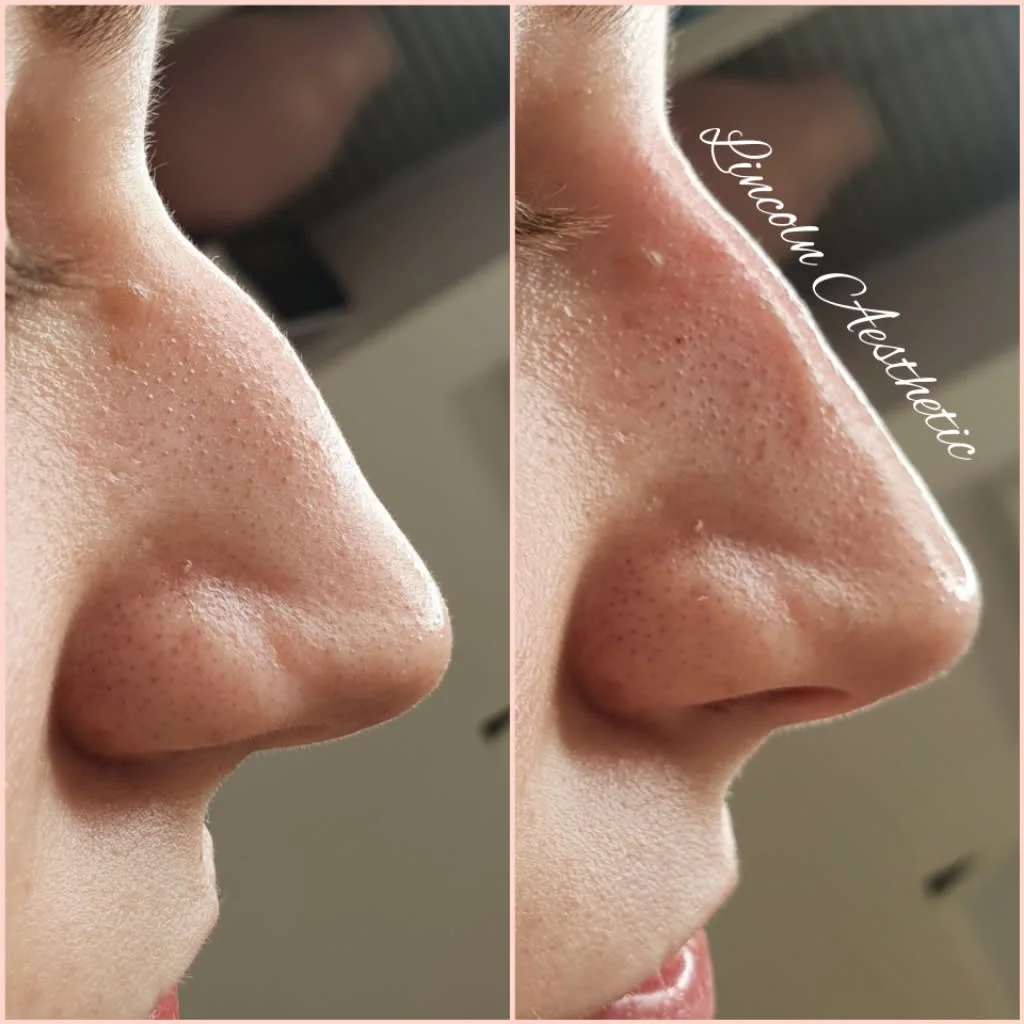 Images Lincoln Aesthetic