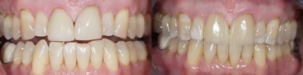Images Watters Creek Dental