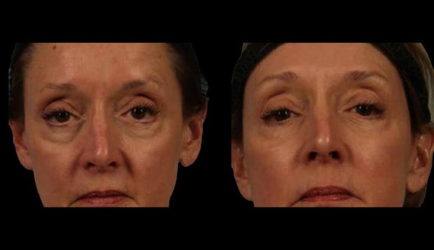 Images Marietta Plastic Surgery