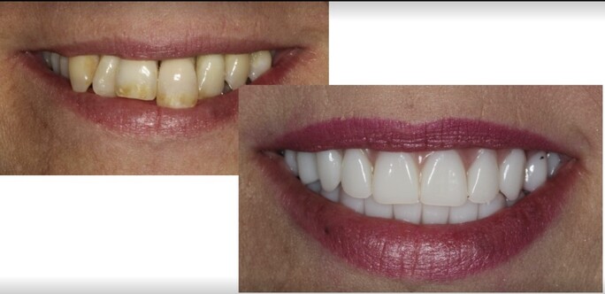 Images WestLake Dental Care