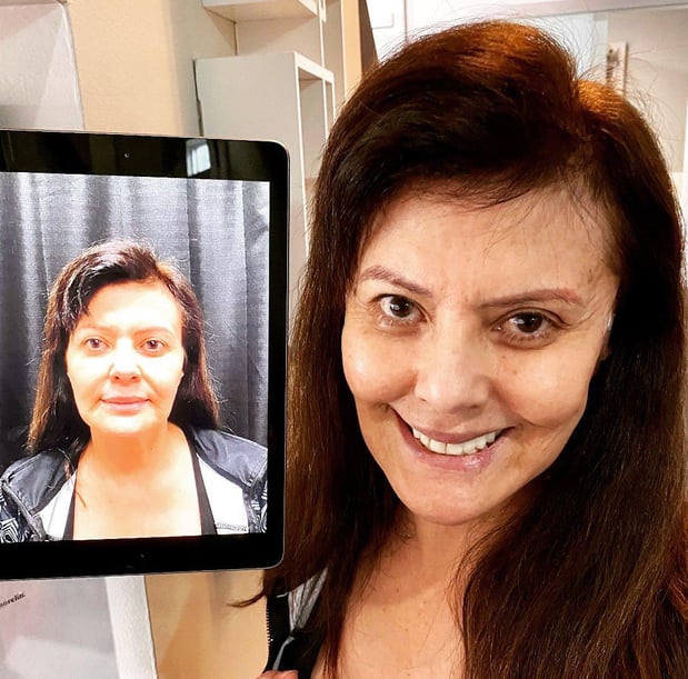 Images Renew Body Contouring & MedSpa