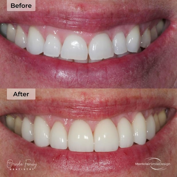 Images Orinda Family Dentistry