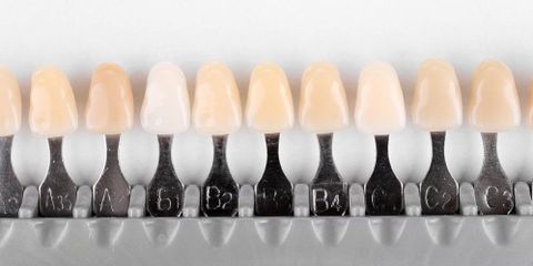 Your Dentist's Top 5 Reasons to Give You a Crown