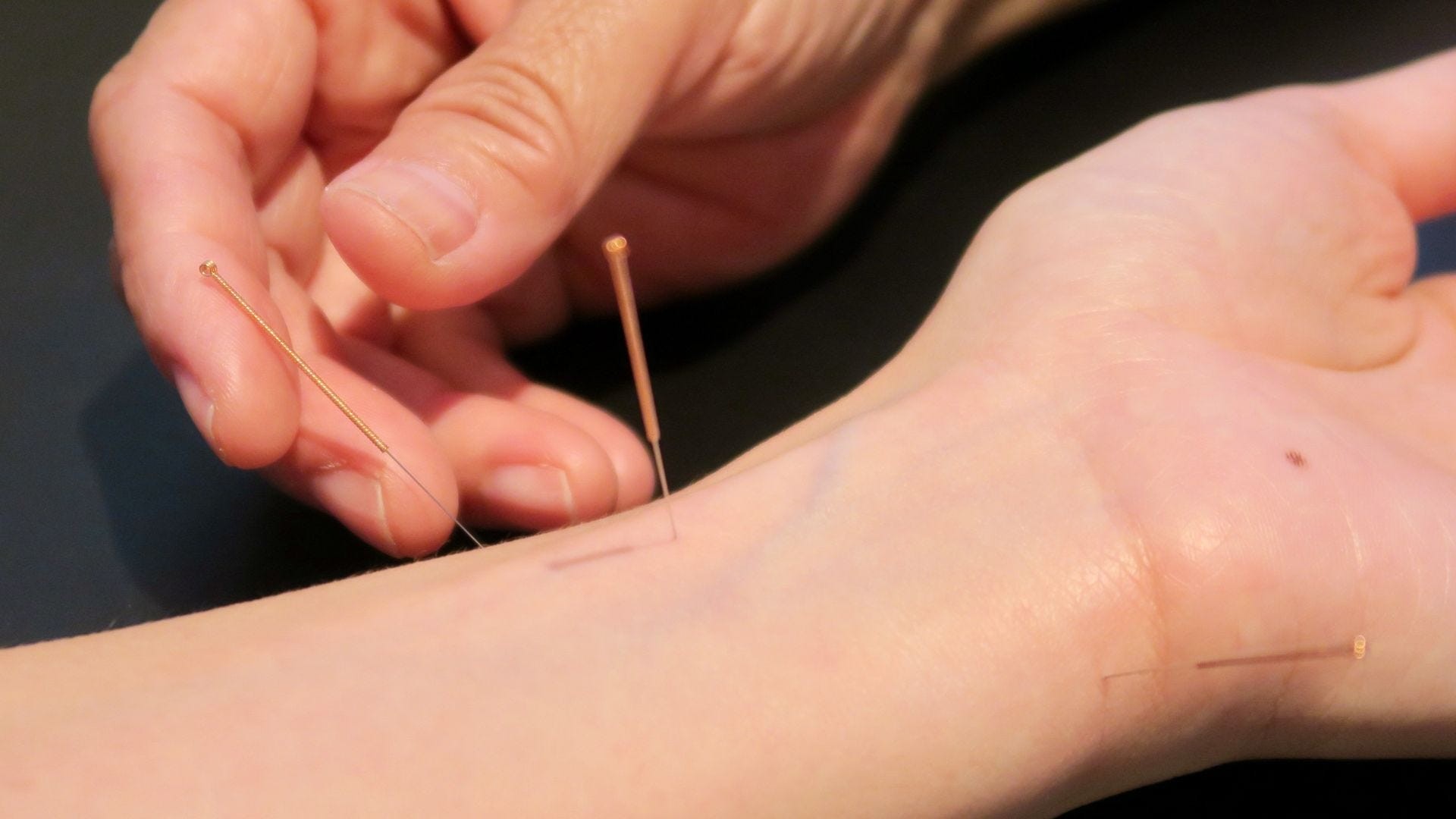 Praxis für Akupunktur, TCM, Phytotherapie, Kräutermedizin, Tibetische Medizin, Kirchenfeldstrasse 31 in Bern